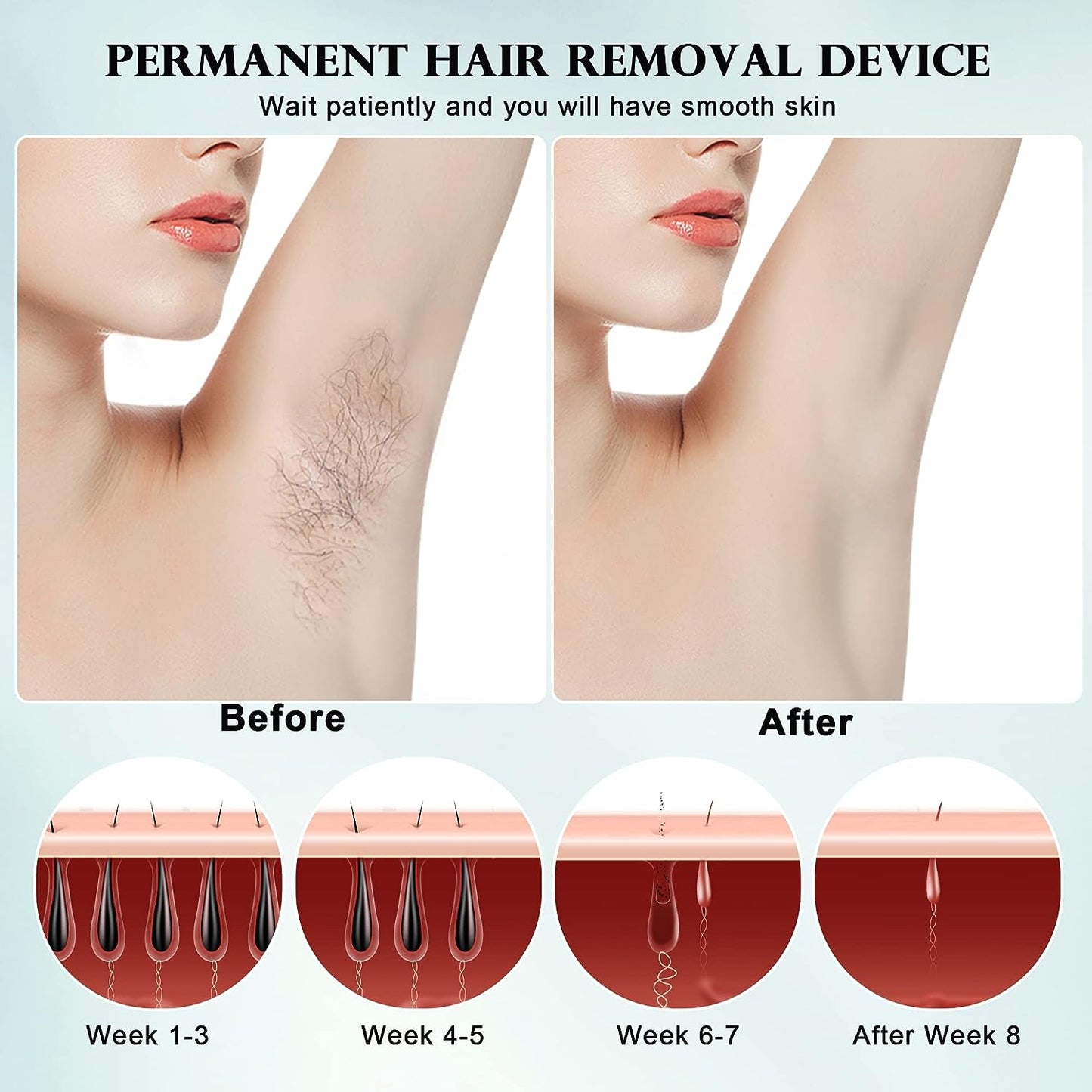 Laser Hair Removal with Cooling System, GP590 IPL Hair Remover for Women and Men, 45°F ICE Compress Contact, Safety Mis-Touch Sensor, at Home Painless Hair Removal Device for Face & Whole Body